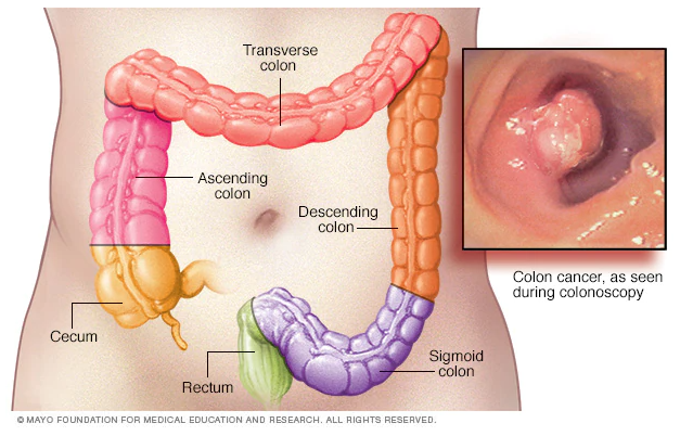 Colon Diagram