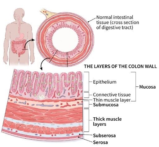 Colon Diagram